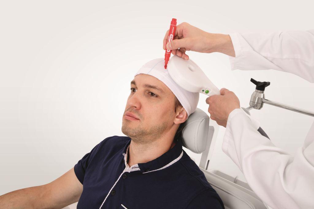 Illustration representing focused transcranial magnetic stimulation.